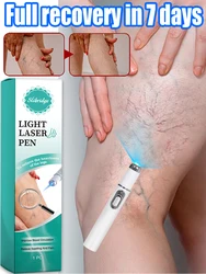 Blue Laser Heals Leg Veined