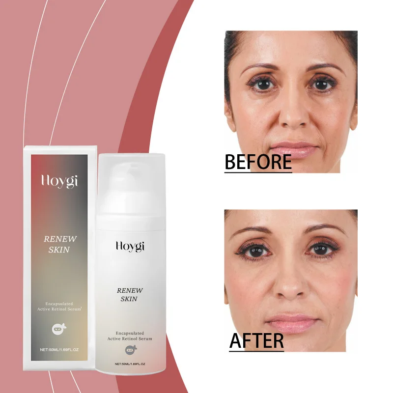 

Retinol Essence Lotion - 50ml Hydrate & Firm, Restore Elasticity, Brighten Skin Tone, Daily Face & Neck Care