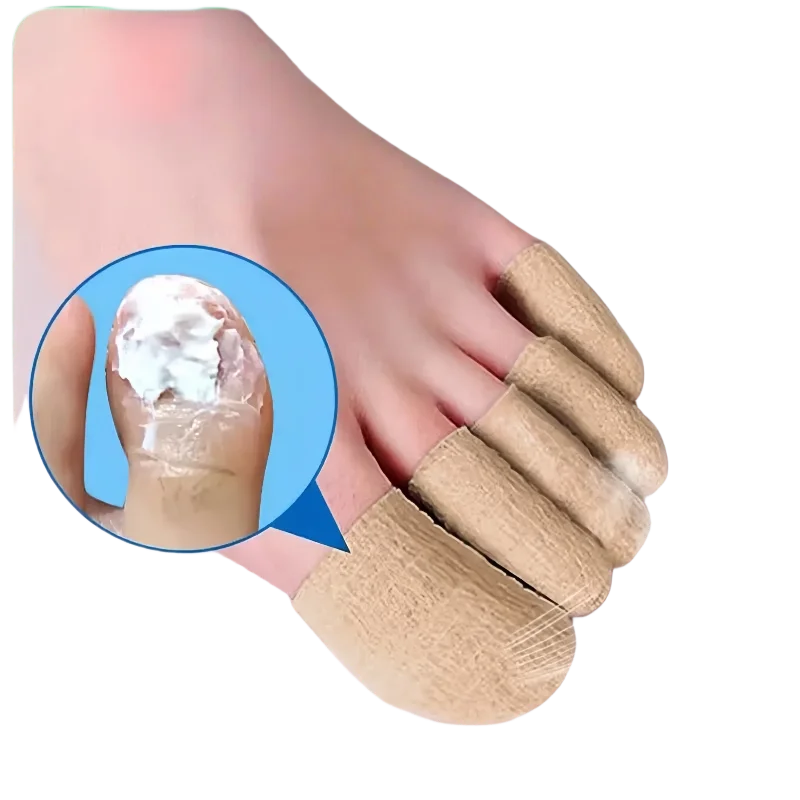 

Fungal Nail Polish, Nail Coating, Toe Protection, Foot and Finger Protection, Self-adhesive Bandage, Toe and Finger Protection