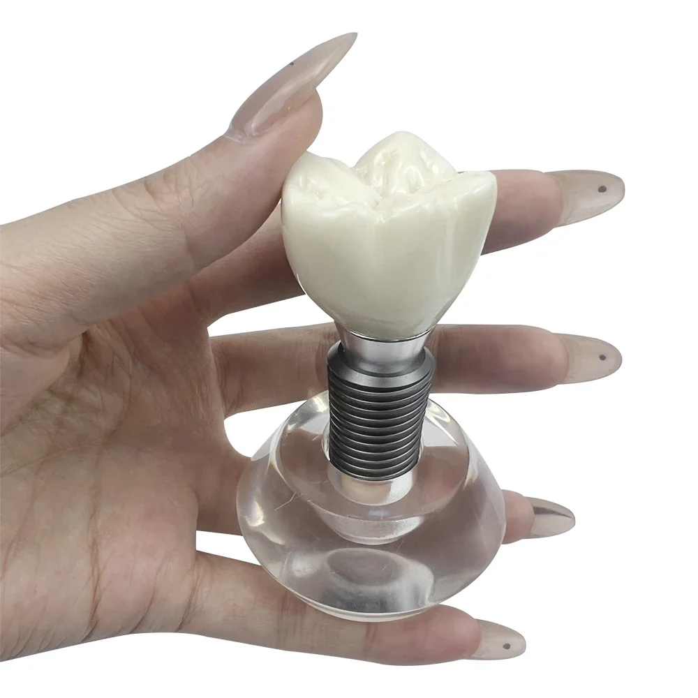 Clear Implant Denture Model Crystal Dental Implant Teeth Model Crown Typodont Structure For Teaching Studying Practice Training