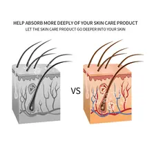 Skin Care Device RF LED #2