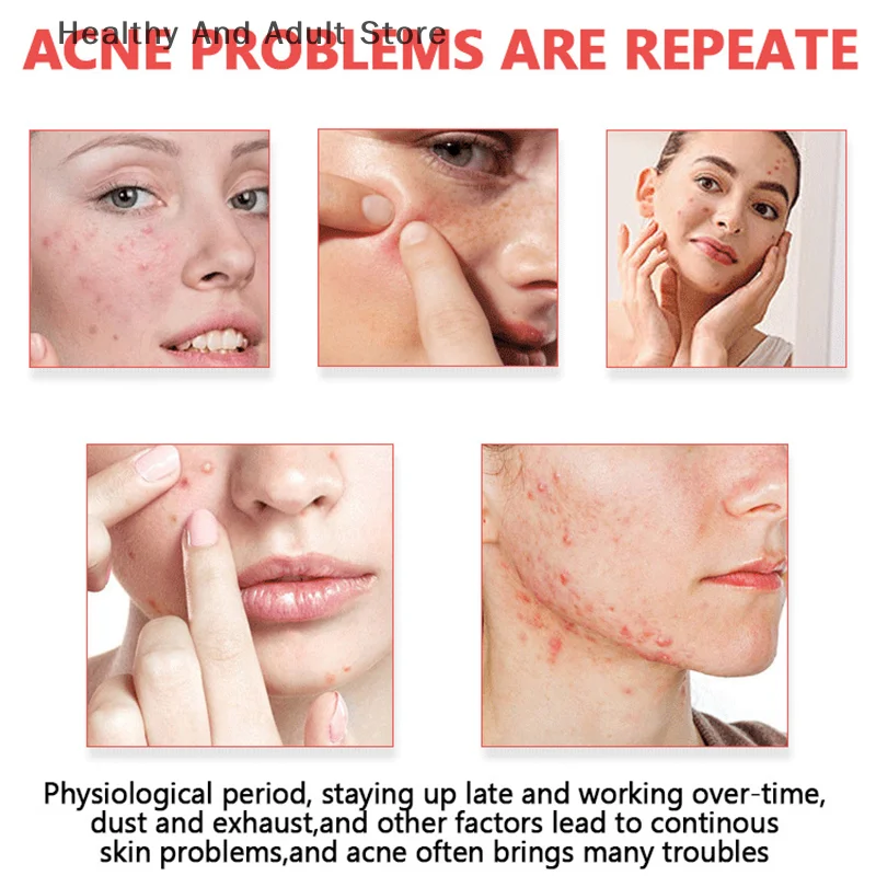 200 teile/satz Gemischte Farbe Cartoon Akne Aufkleber Sternförmige Herzförmige Kreisförmige Aufkleber Hautpflege Und Gesichts Make-Up Werkzeuge