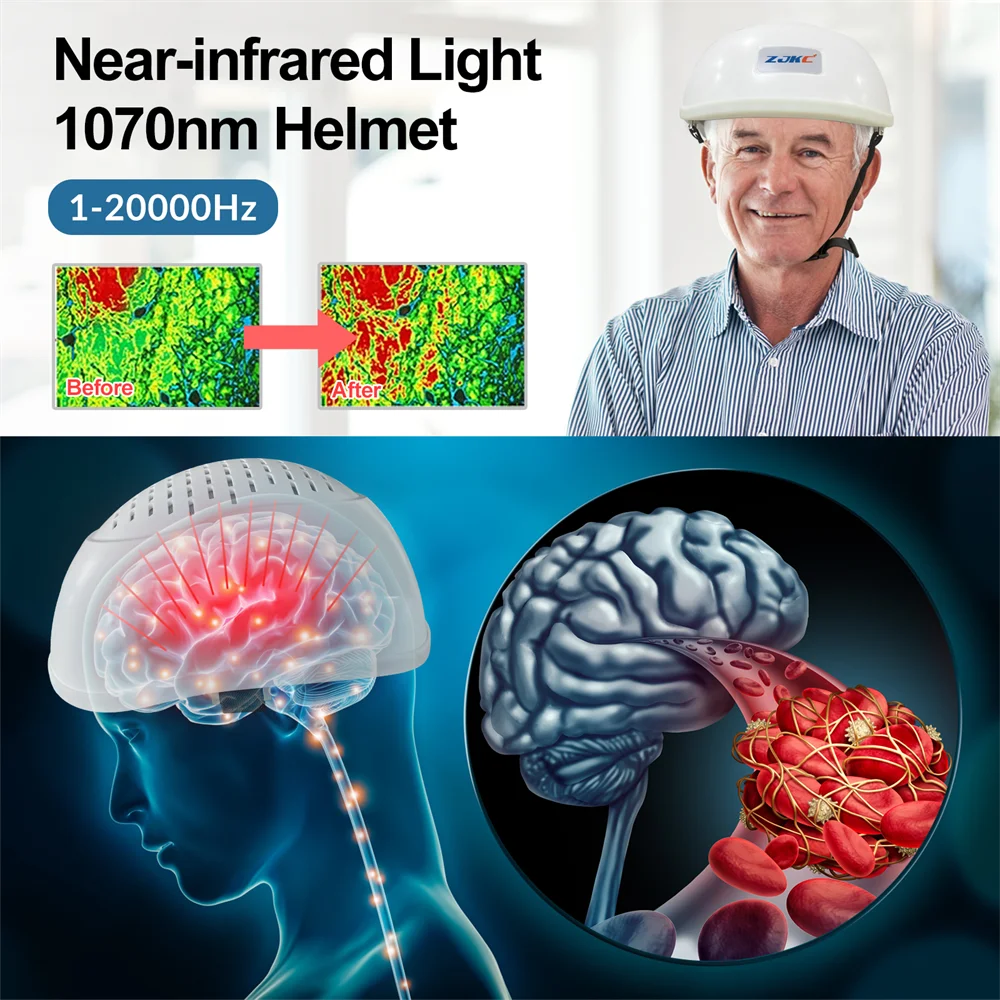 ZJKC Infrared Light Helmet 1070nm Dementia Therapy Gadgets for Stroke Victims Boost The Brain Activities Enhance Cognition