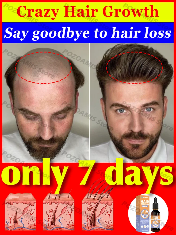 

More and more hair, say goodbye to baldness