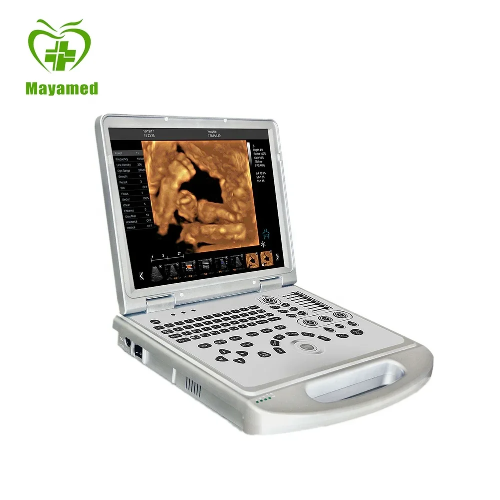 MY-A024B-N Portable advanced imaging technology Laptop CW Color Doppler Ultrasound Scanner