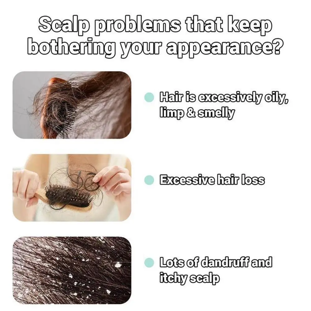 

Shampoo Plant Extracts Anti Hair Loss Hair Conditioning Shampoo Promote Dandruff Hair care products