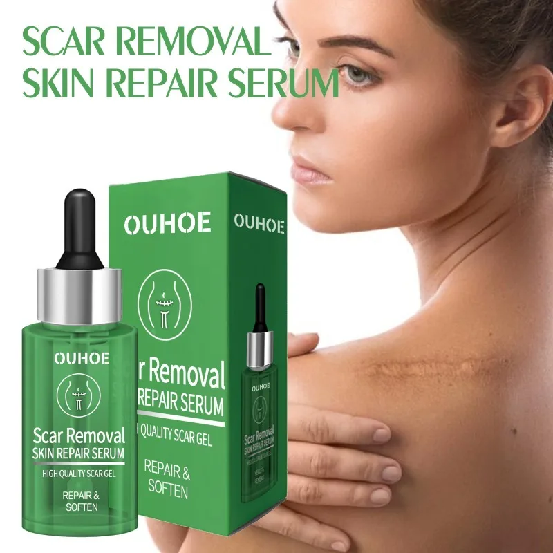 Scar Removal Skin Repair Serum Facial Acne Scar Burn Surgical Scar Spot Marks Repair Firming Smooth Pore Shrinking Skin Care