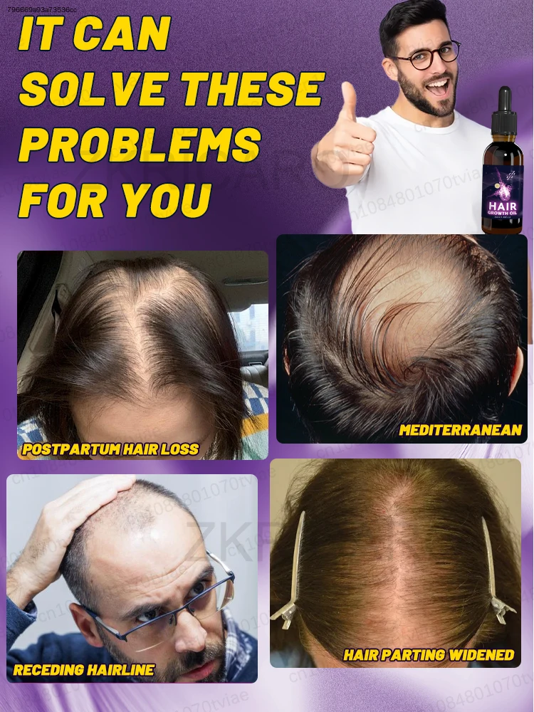 Hair Root Care Essential Oil, Balance Scalp, Improve Dry Strands, Fuller Hair Look.