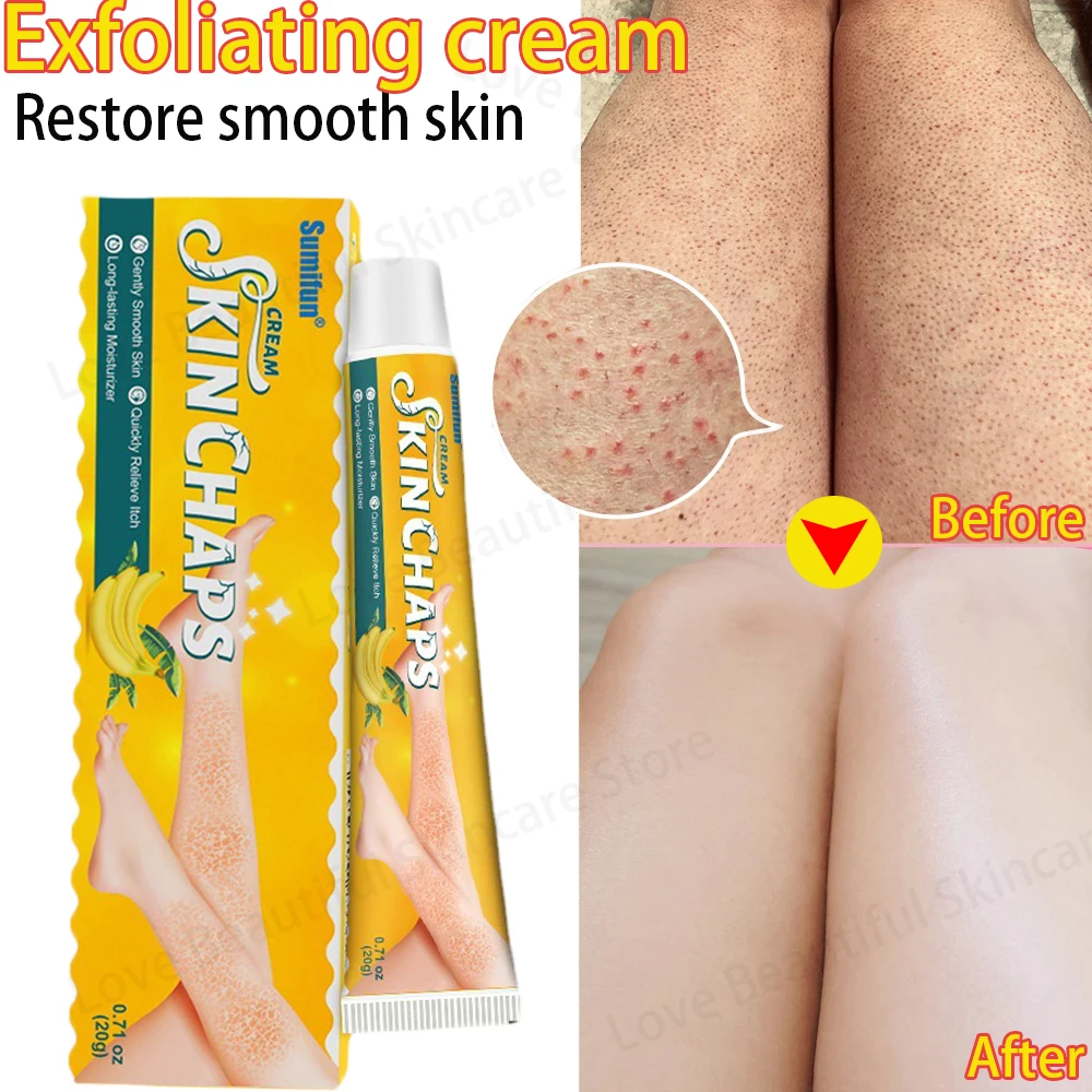 

Removal Chicken Skin Cream Curing Keratosis Pilaris Repair Cream Body Dark Spots Removal Brighten Moisturizing Smooth Body Care