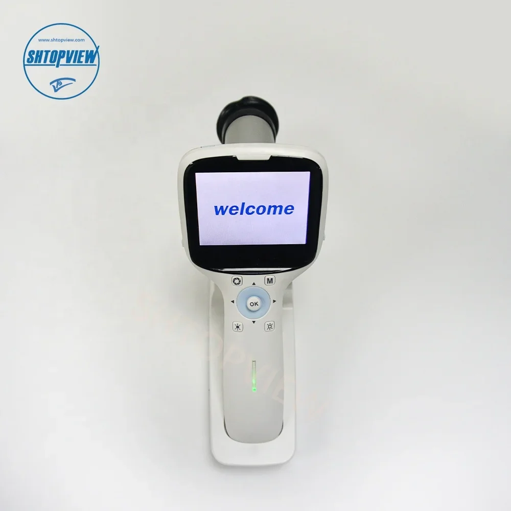 Top quality Non-mydriatic eye fundus camera MS-01 Digital Retinal Scan Photography