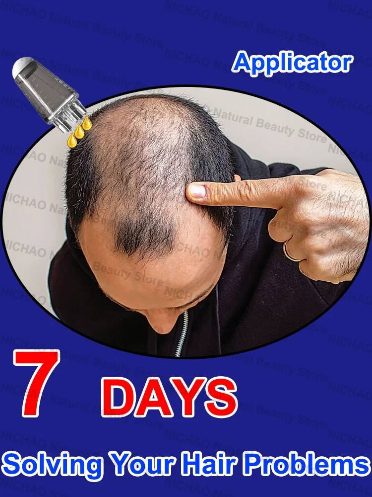 

7 Days Fast Hair Growth Essential Loss Regrowth Treatment Strengthens Hair Nourishes Scalp Light Weight Non Greasy