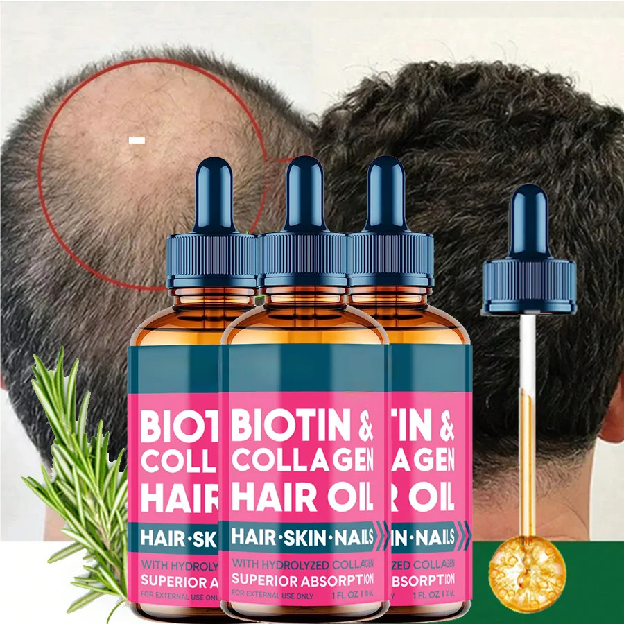 

3 件套 Biotin Fast Growing Hair Care Essential Oils Anti Hair Loss Oil Treatment, Moisturizing Hair, for Men Women