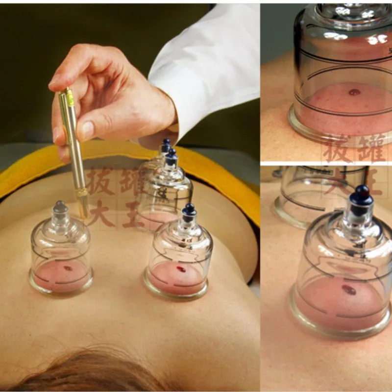 مجموعة خزان الحجامة المنزلية الراقية 19 علبة تنفيس صف الدم خزان الوخز بالإبر تدليك الصحة