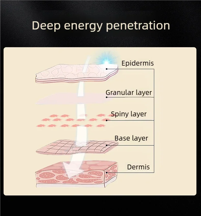 EMSコラーゲンキャノン美容機器 RFスタンプマイクロカレント 3モデル 3色LED 38-45 ℃   アンチエイジング しわ改善 リフトアップ効果のあるフェイシャルツール