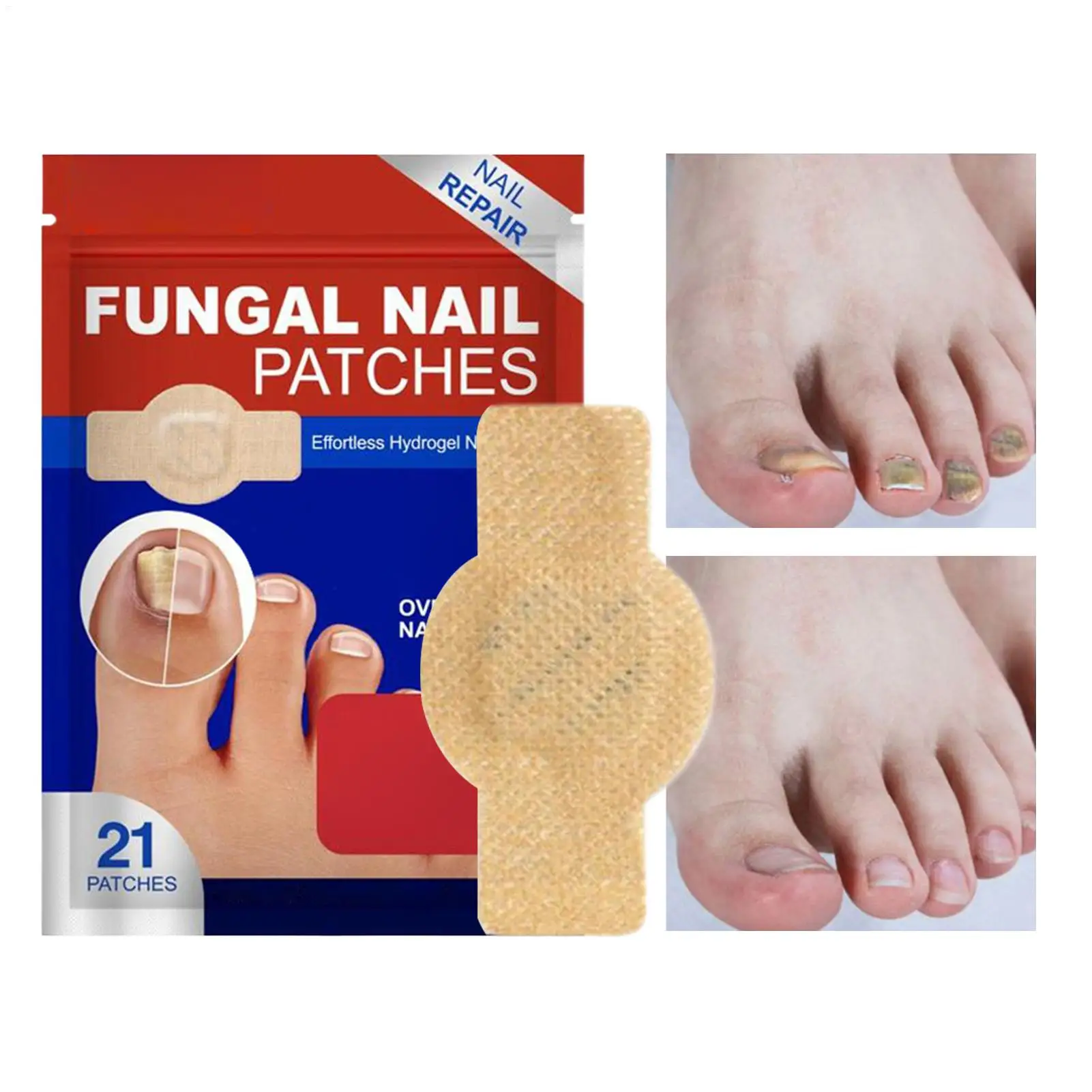 NailFungus Patch Wasserdichter Nagelreparaturpflaster Eingewachsene Korrekturaufkleber Beschädigter Nagel Graues Pflegepflaster Fußpflegewerkzeuge