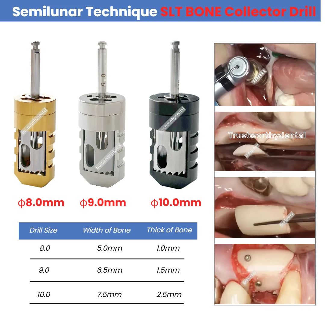 3 حجم الأسنان SLT كتل العظام الحصاد الحفر GBR تقنية Semilunar زرع العظام جامع نصف القمر الحصاد الحفر الأكمام المعدنية