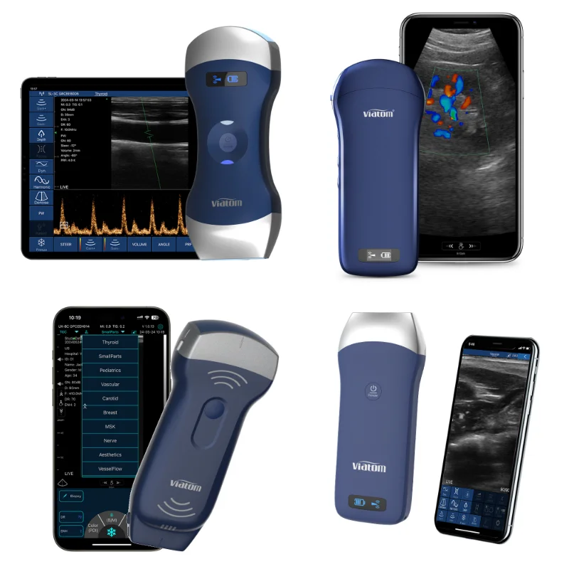Viatom ABC 192 Element Color Doppler Wifi Wireless Ultrasound Frequency Scanner Portable Handheld Ultrasound Probe Multipurpose