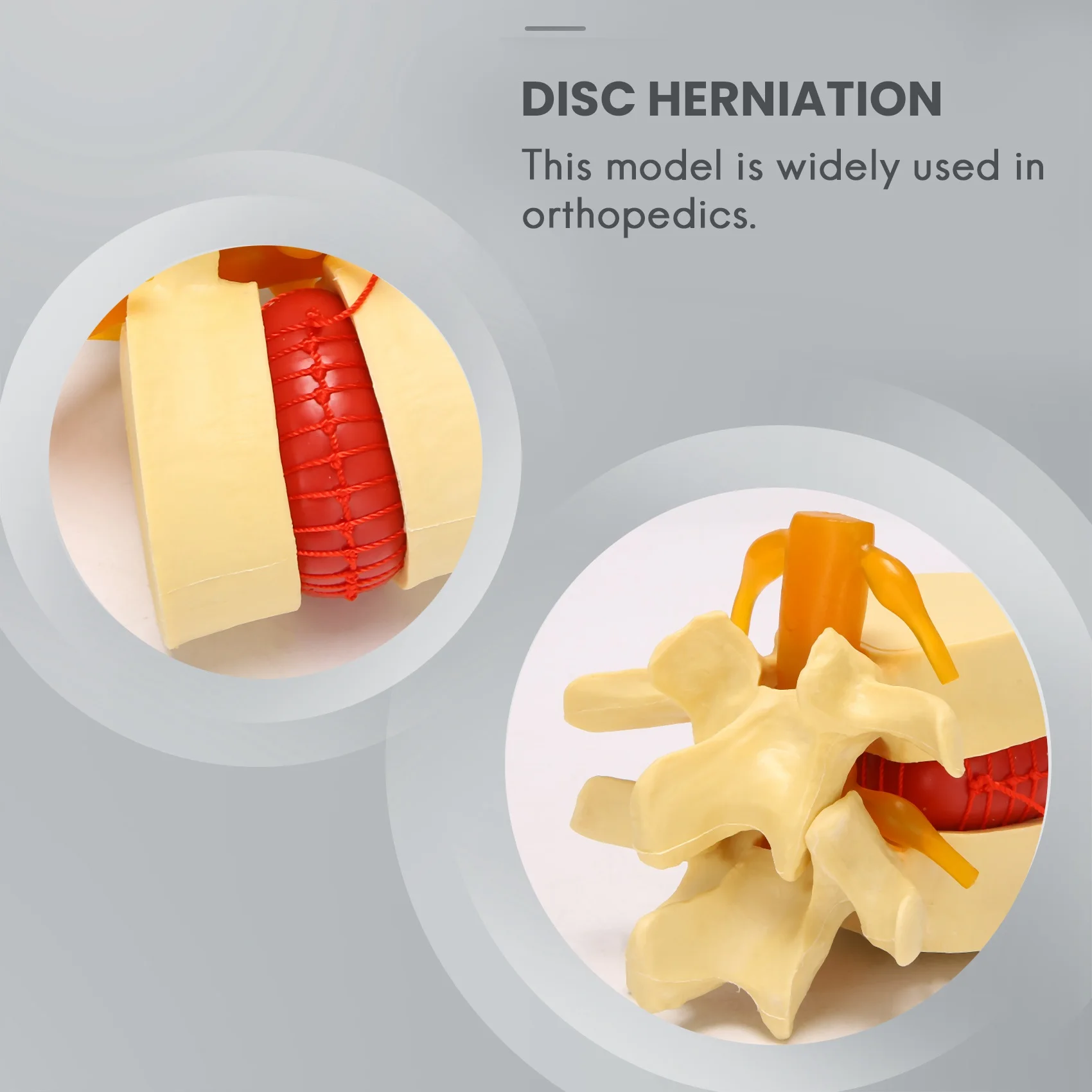 B92B-Lumbar Vertebrae Model Anatomical Spine Lumbar Disc Herniation Anatomy Teaching Tool Lumbar Vertebrae Model
