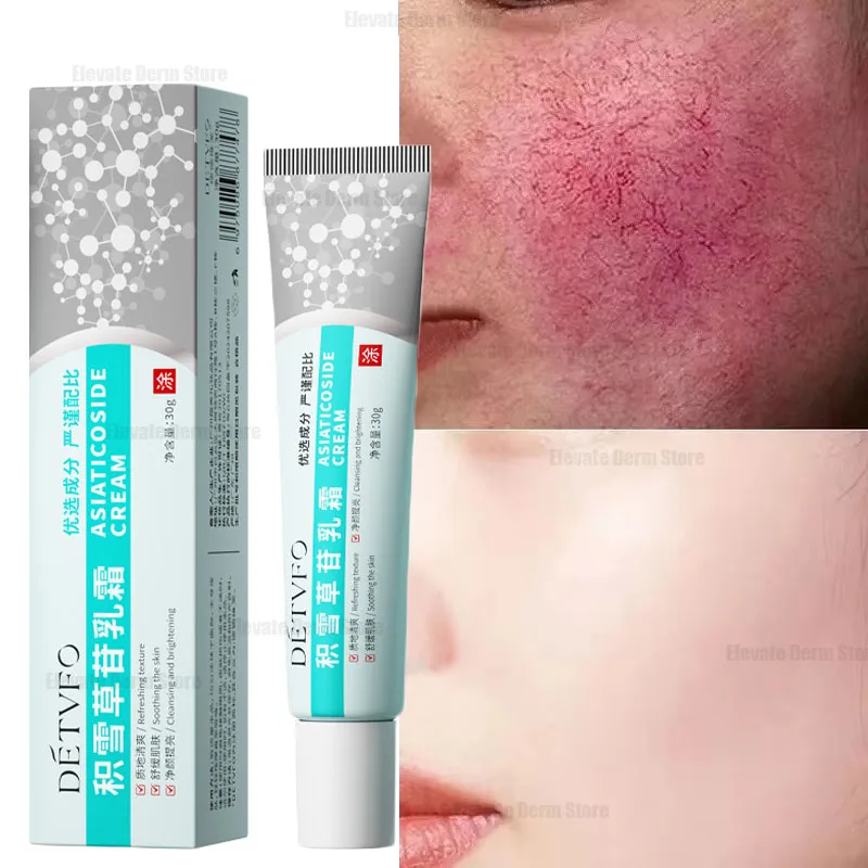 Repair Facial Redness Cream Instant Spider Vein Remove Sensitive Skin Sooth Anti Redness Rosacea Treat Lotion Korean Cosmetics