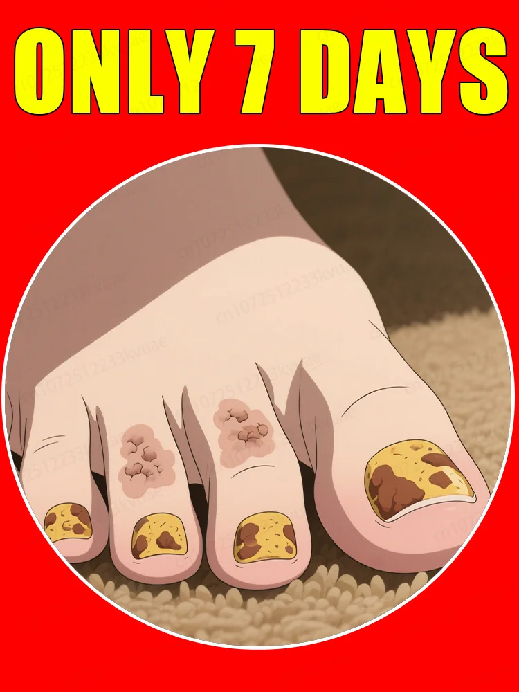 

manicure for bad Can in 7 days farewell