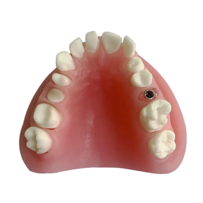 

YTYIN Prosthesis Display Model Soft Silicone Mold, Porcelain Tooth Material