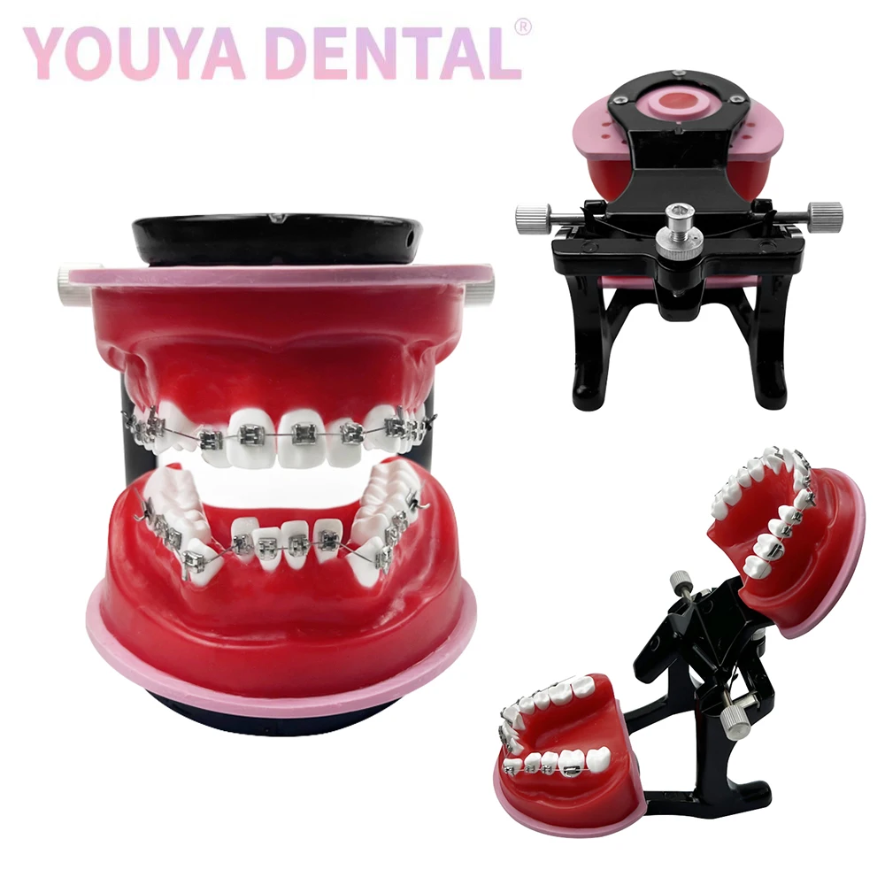 Orthodontics Typodonts Model Gum Wax Dock Teeth Practice Model Orthodontic Repositioning Mold Is Used dentisit Student Practice