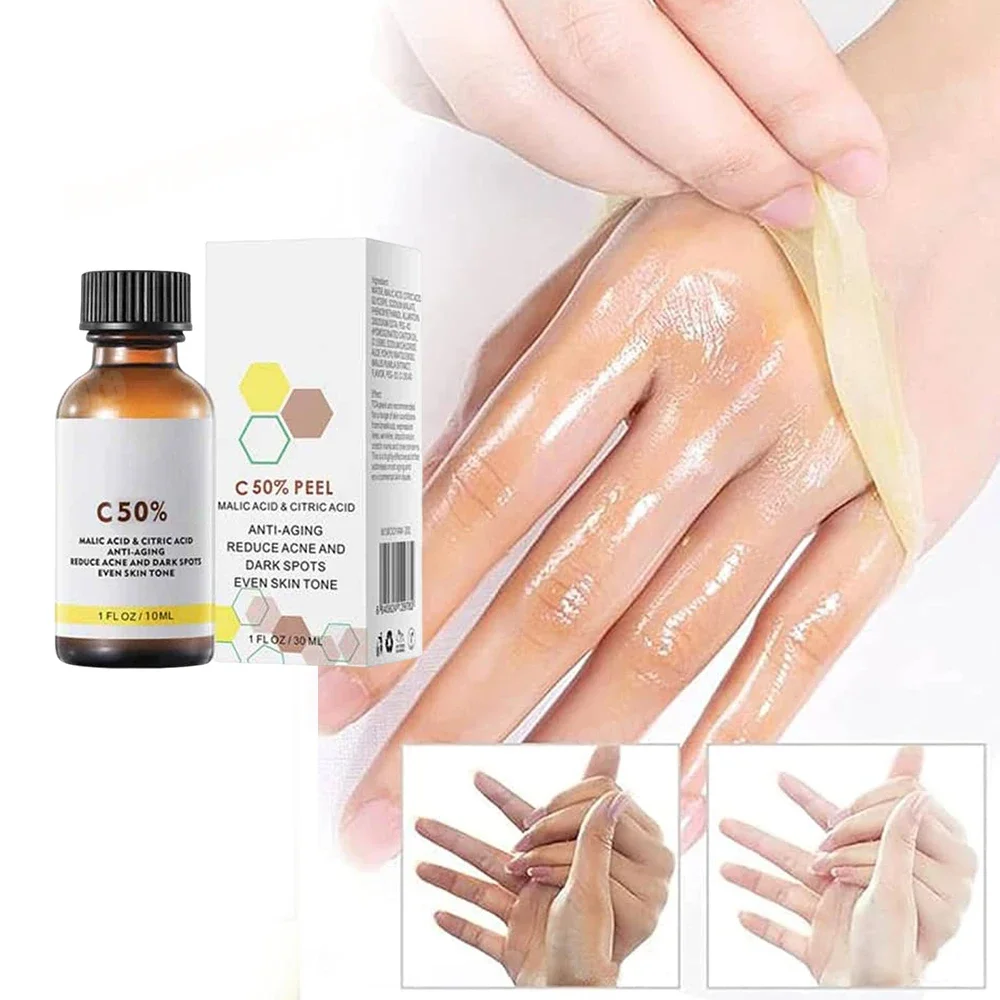 With Malic Acid And Citric Acid For Face  Facial Peel 40% Peeling Serum Peeling Serum Chemical Peel