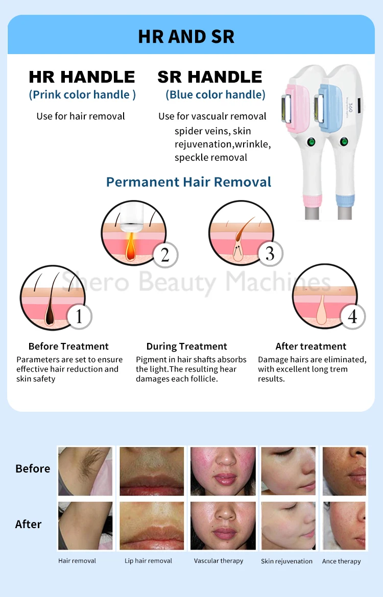 360 مغناطيسي Elight OPT مقبض إزالة الشعر M22 مقبض تجديد الجلد Nd Yag مقبض لملحقات آلة إزالة الشعر إزالة الوشم #6