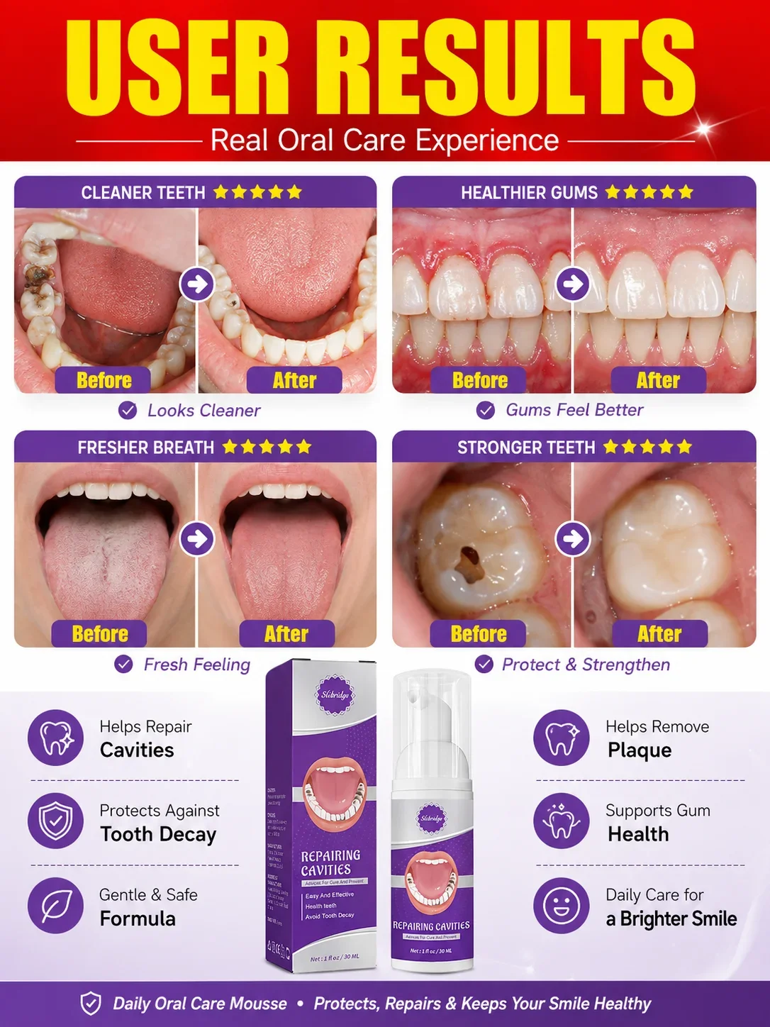 **Daily Enamel Tooth Mousse for Men and Women, Gentle Tooth Surface Care After Meals Snacks and Sweet Foods
