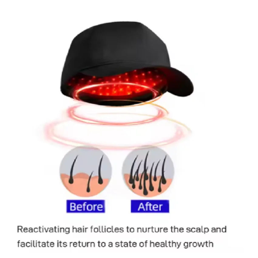

2760 durl wavelength 650nm+808nm Laser cap laser helmet 276 medical diode lasers red lights therapy hair