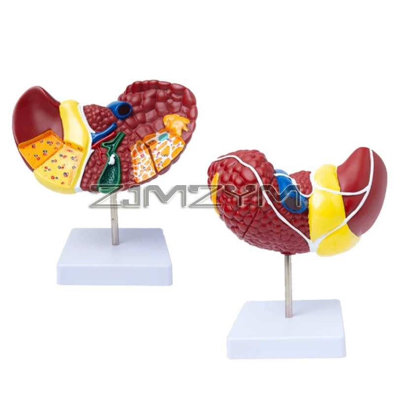 Pathological Liver Anatomical Model 1:1 Human Liver Model Anatomy Display for Medical School Study and Research