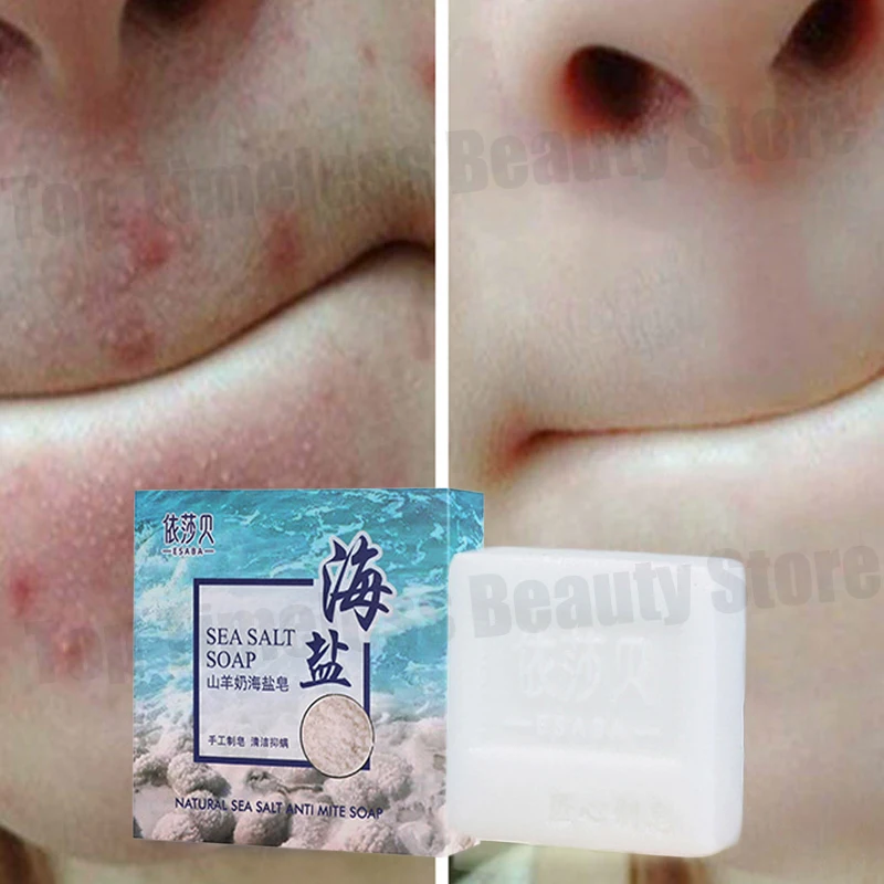 

Sea Salt Body Acne Removal Soap Treatment Face Butt Back Acne Marks Smooth Repair Chicken Skin Moisturizing Whitening Skin Care