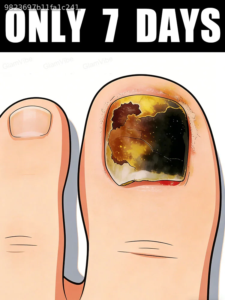 

Снижите уровень тревоги и перестаньте постоянно беспокоиться о ногтях.