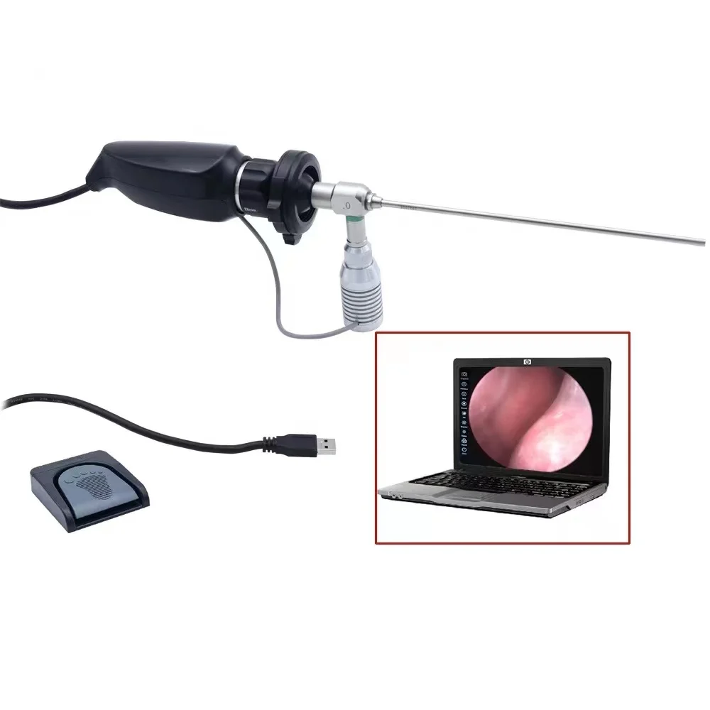 

YD-602K high-definition medical portable USB veterinary endoscope camera with light source, high-resolution surgical camera