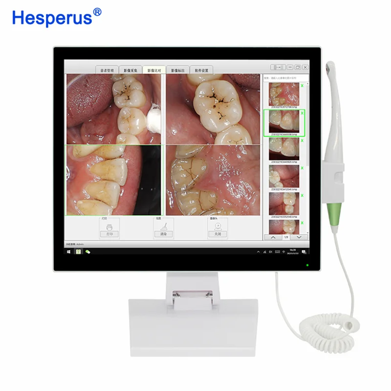 17 inch Touch Screen mon itor Den tal INTRA ORAL cam era scanner Wireless wifi Endoscope all-in-one HD Den tal Equipment