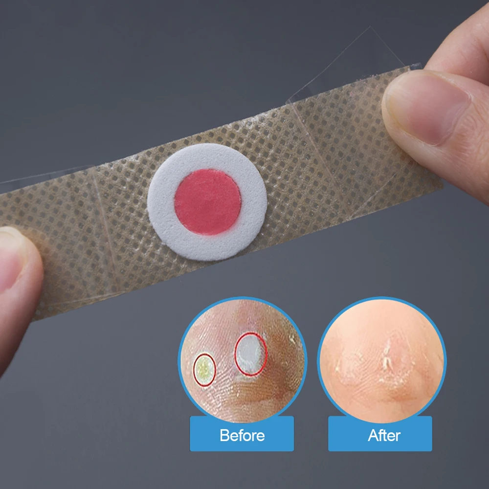 وسادة إزالة الكالس غير المنسوجة ، 42 ، وسادات إزالة الكالس ، عملية ، مفيدة