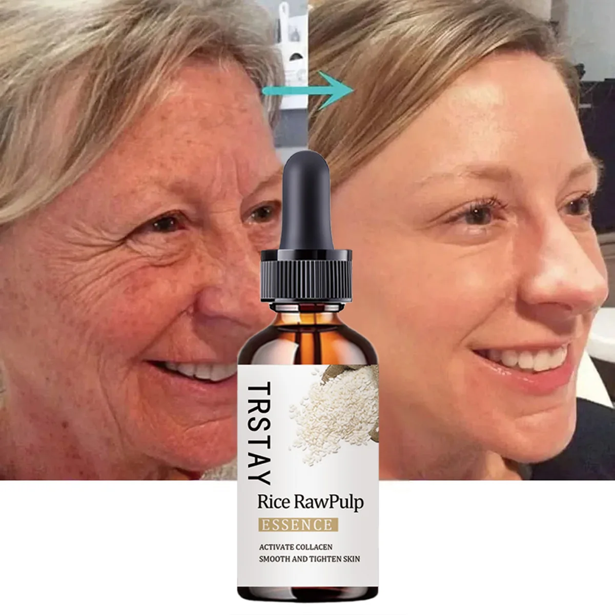 

TRSTAY Рисовое сырье Эссенция для лица Коллагеновая активация Разглаживание и подтяжка кожи Антивозрастной уход за кожей для мам