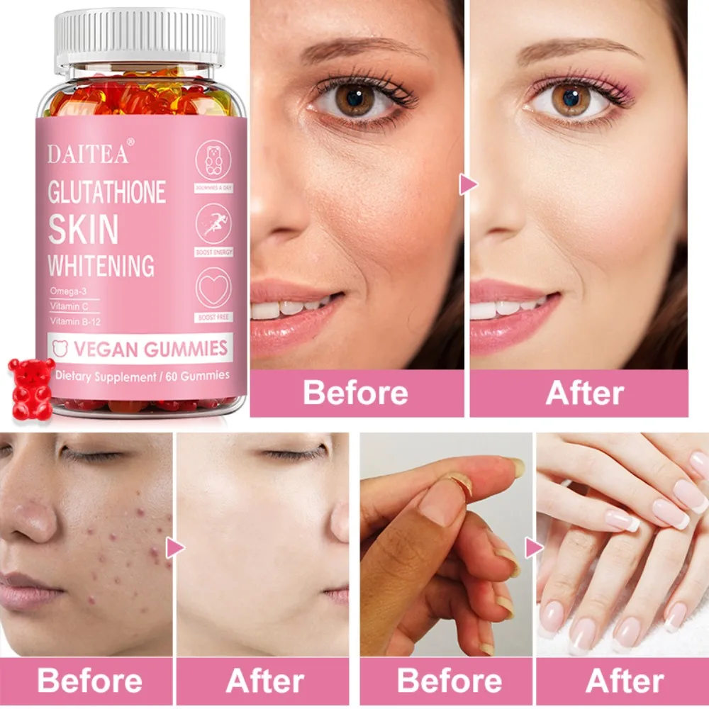 Glutathione Gummies Nourishes Skin Antioxidants Anti Aging Immune Support