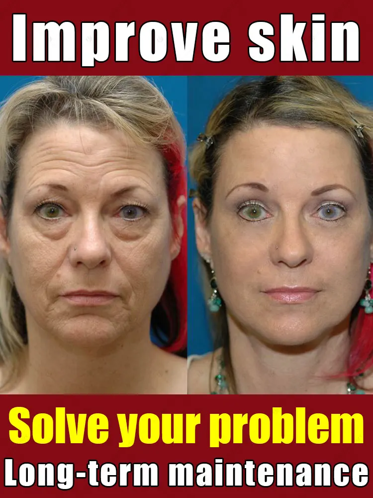 

Нет тонких линий. Твердый и яркий.