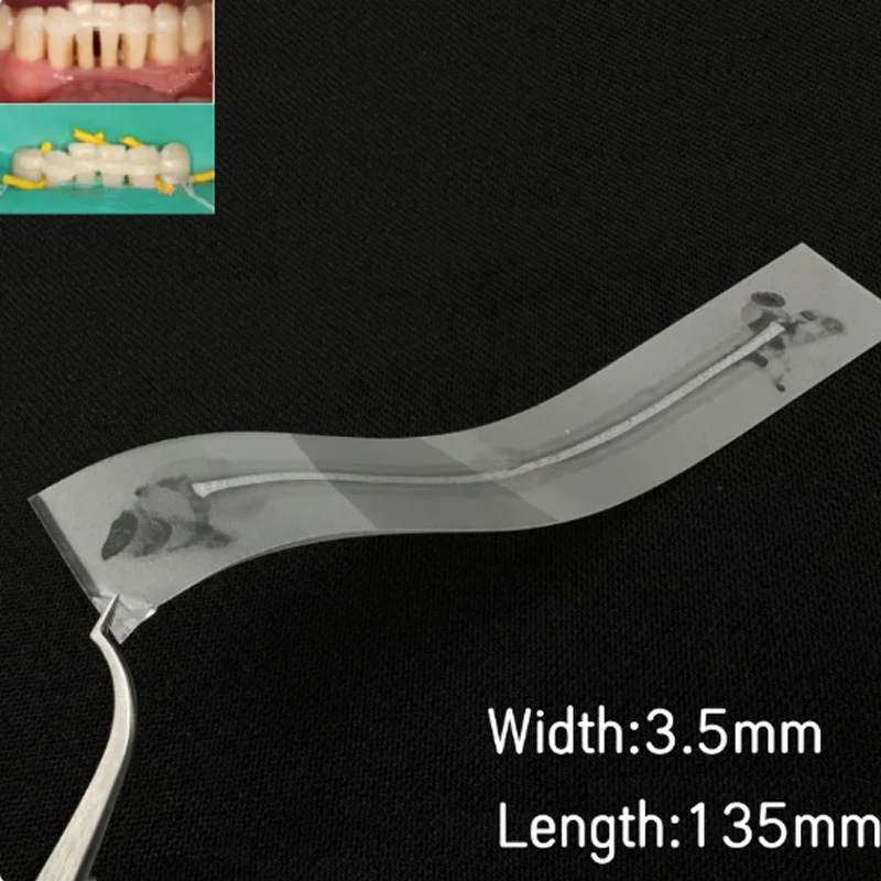 10 Stuks Tandheelkundige Glasvezel Strip Spalk Flexibele Vezel Strip Licht-Hars Cure Binding Strips Tandheelkunde Materiaal