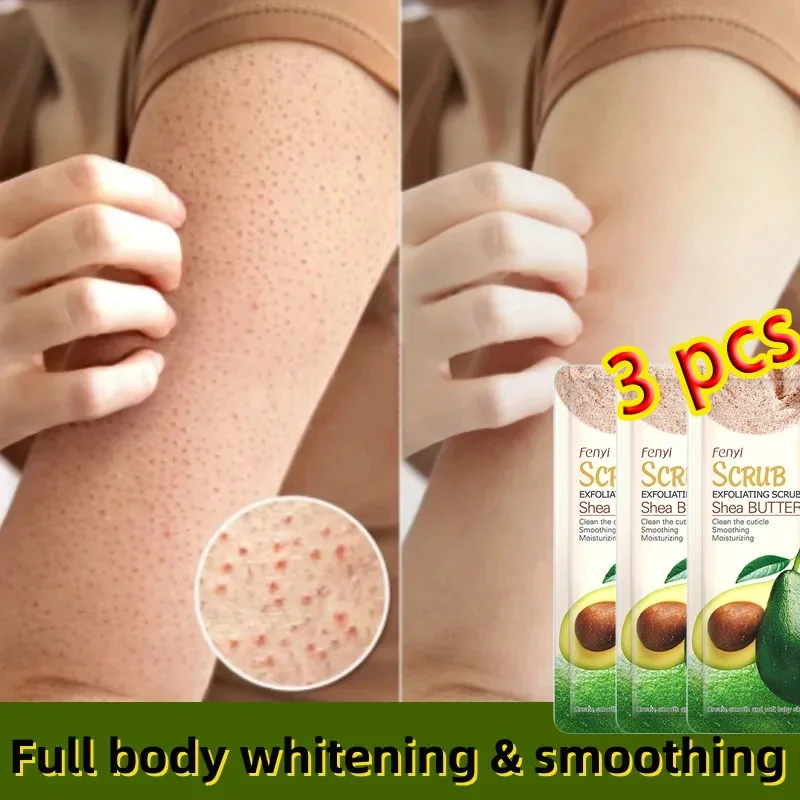 Removal Chicken Skin Scrub Cream Curing Keratosis Pilaris Repair Cream Body Dark Spots Removal Brighten Moisturizing Body Care