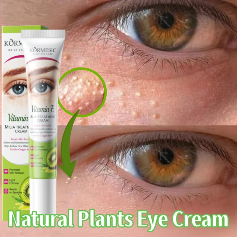 Anti Fat Granules Eye Cream  Eye Milia Repair Treatment Products Improve Eye Bag Anti-Puffiness Moisturizing Lift Firm Skin Care