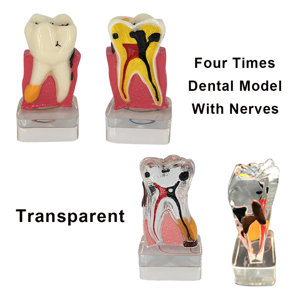 

Модель стоматологической анатомии, патология с демонстрацией нервных зубов, обучение, обучение, прозрачная 4-кратная Стоматология для стоматолога, студента