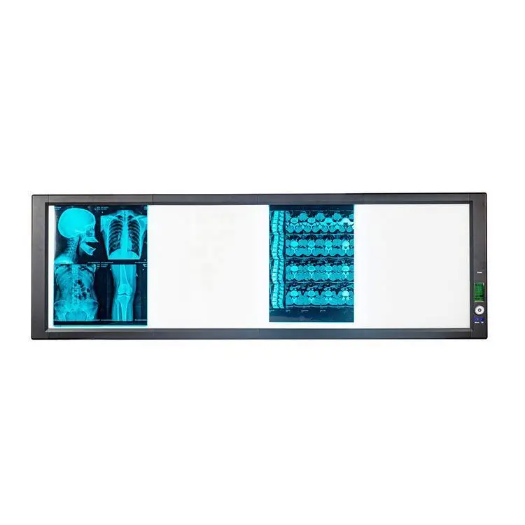 مستشفى Ct آلة المسح عارض الأفلام الأشعة السينية LED عارض الأفلام الشعاعية