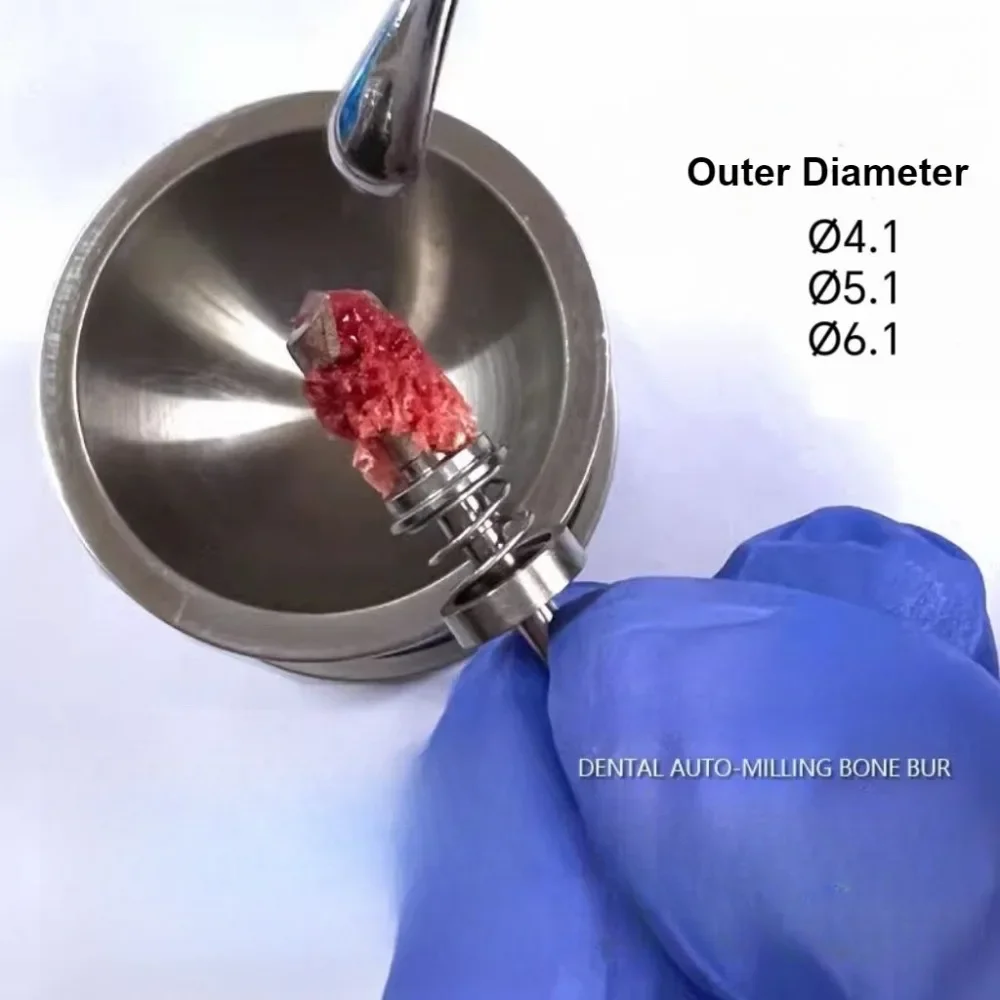 Dental Implant Spring Bone Harvesting Drill Dental Implant Collection Bone Scrap Drill Self-Grinding Bone Extraction Drill
