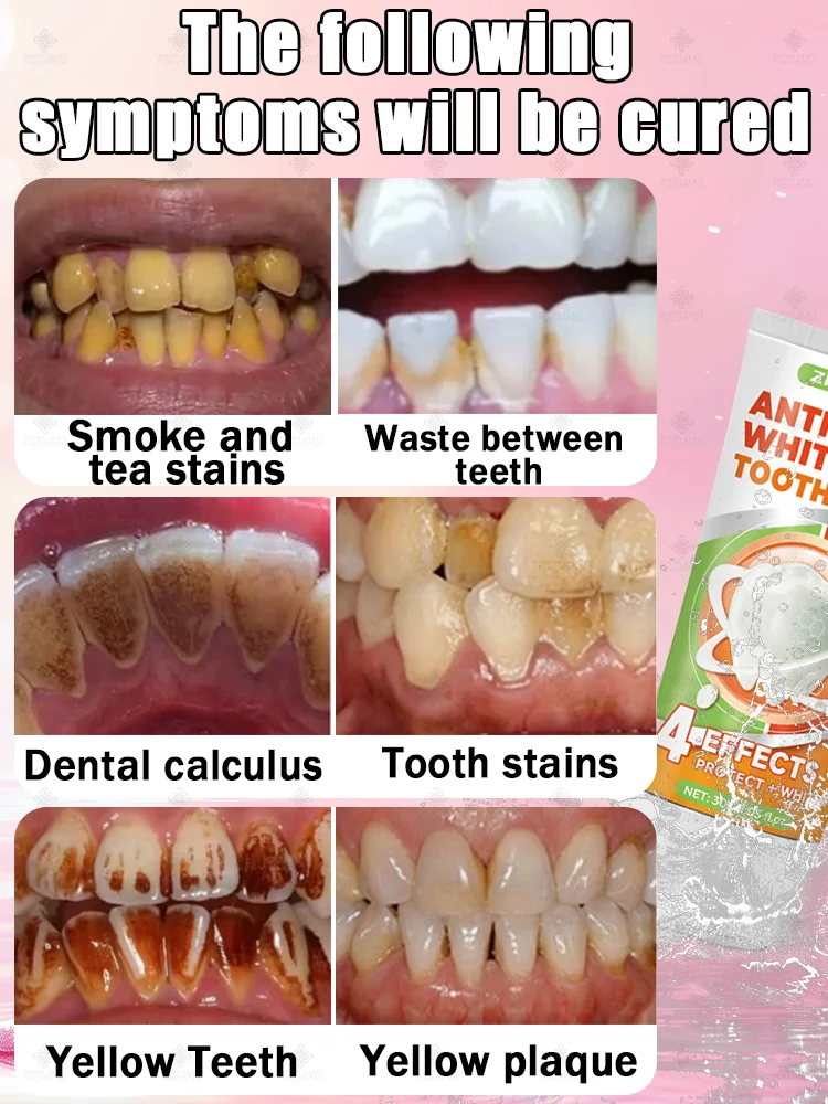 Whitening toothpaste makes your smile whiter and brighter, giving you confidence. - Image 2