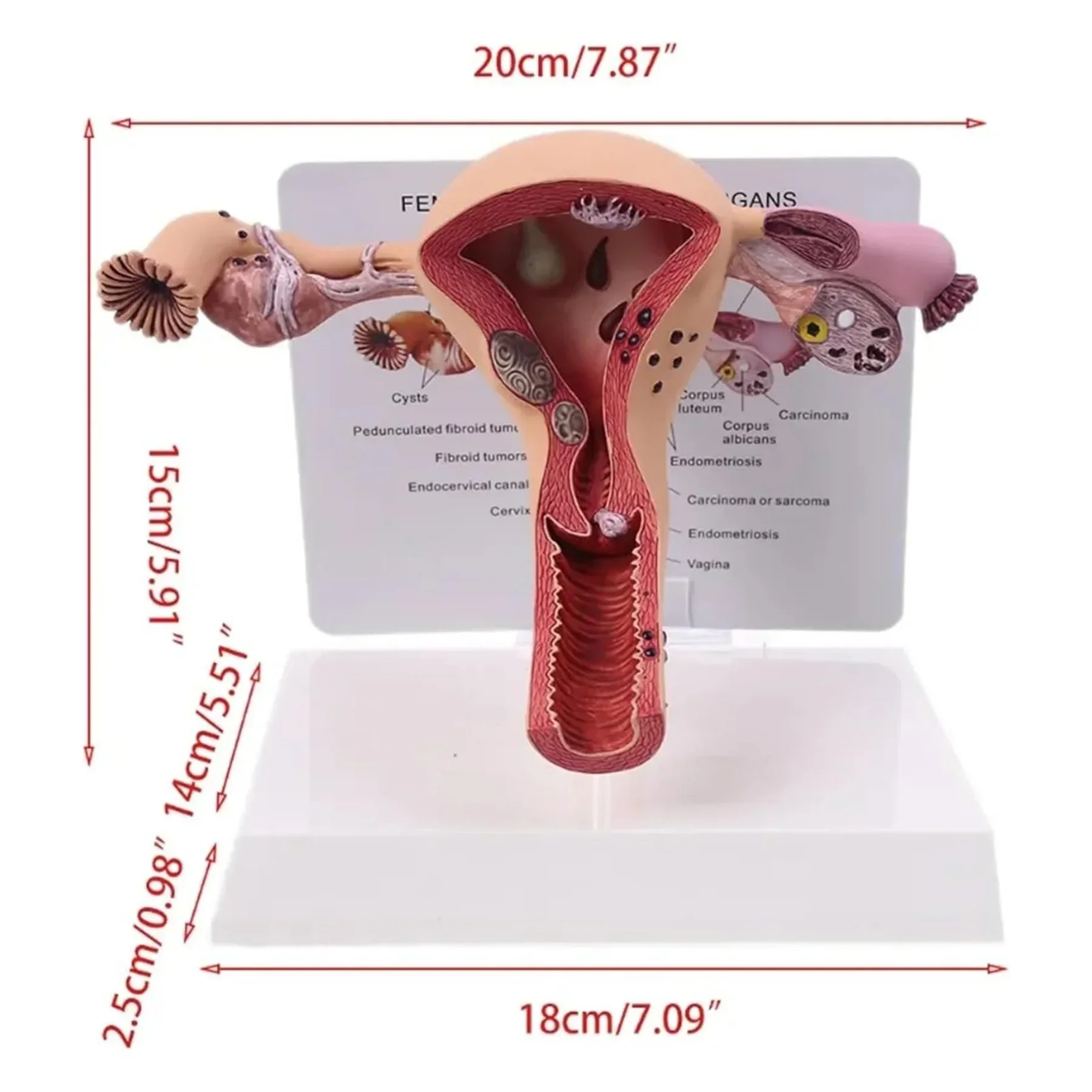 

1Pcs Uterus Ovary Model Pathological Uterus Ovary Anatomical Model Anatomy Cross Section Study Tool Medical Props Model