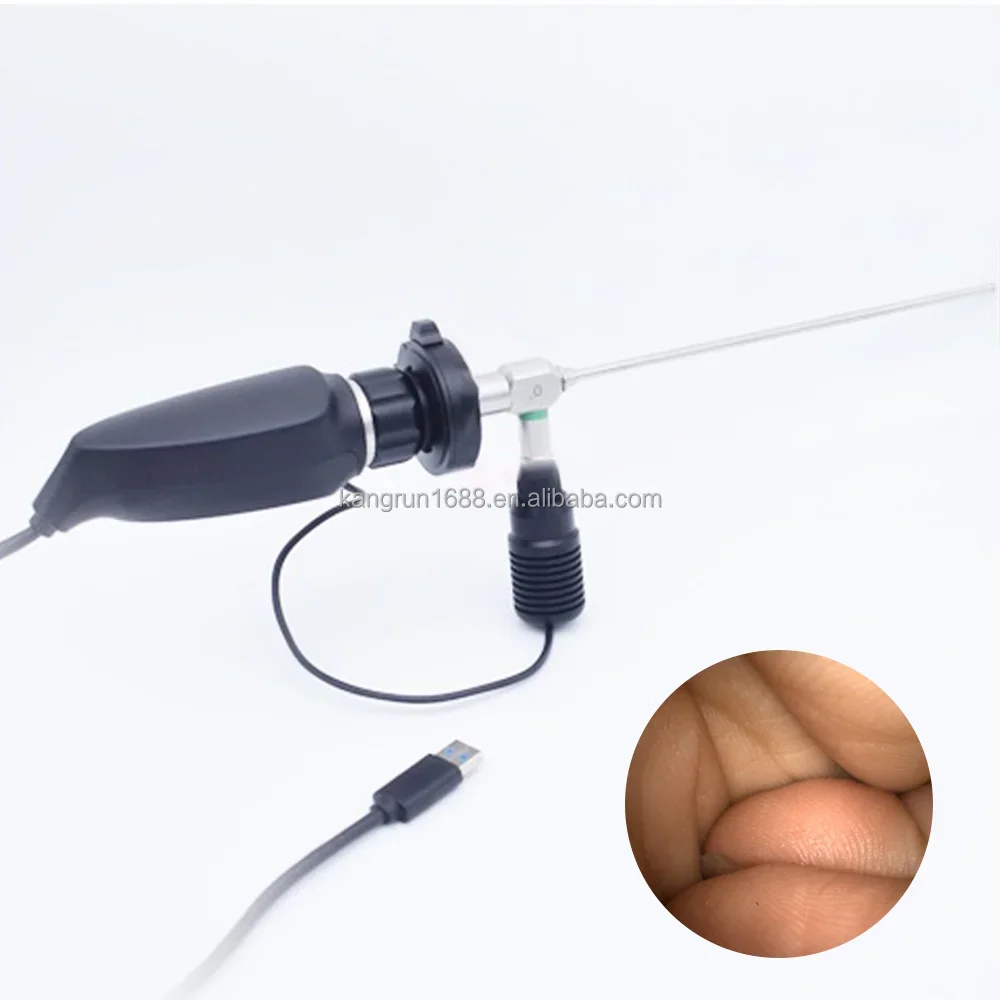 

Portable Full HD 2K Endoscopy Medical Ca-m-era System For Pet Veterinary Ent/Laparoscopic Surgery Ent Endoscopic Hd Ca-me-ra