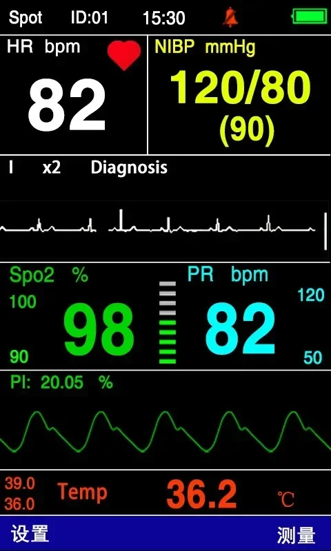2025 PC200 Handheld Mobile Portable Wireless Monitor Multiparameter Vet Monitor de Sign Vital with ECG function