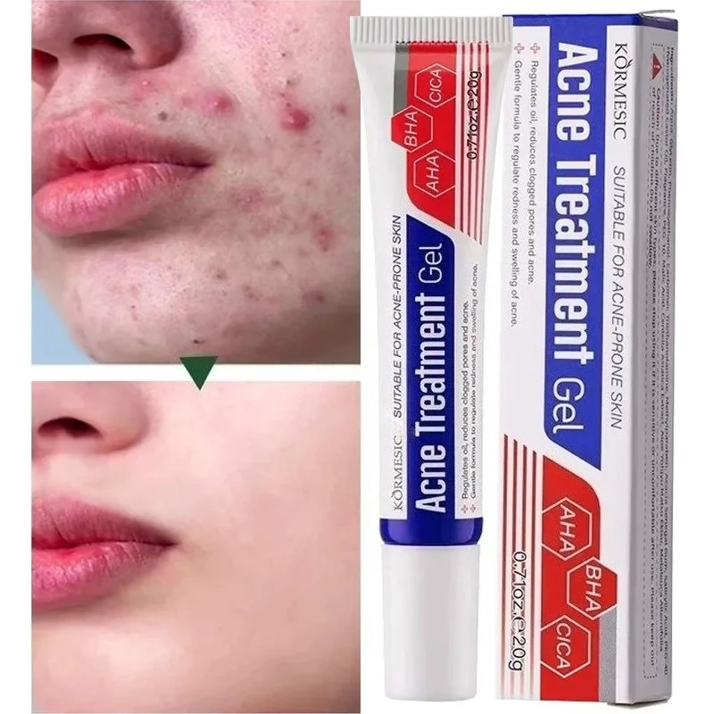 

Acne Removal Cream Anti-Acne Repair Redness Pimple Spots Gel Deep Cleaning Pore Oil Control Moisturizing Skin Care